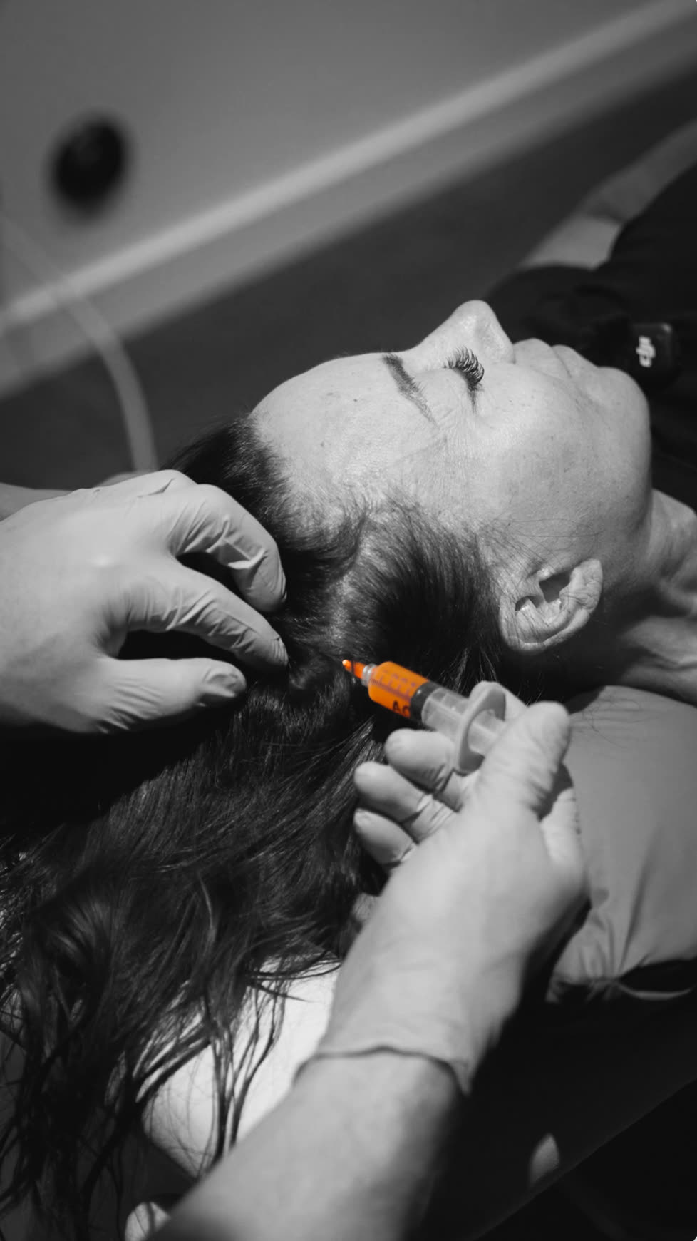 Ett medicinskt behandlingsprogram med blodplättsrik plasma för män och kvinnor med håravfall. Målet är att bromsa förtunningen och stärka de hårsäckar du har.